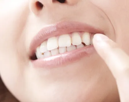 治療終了・保定期間