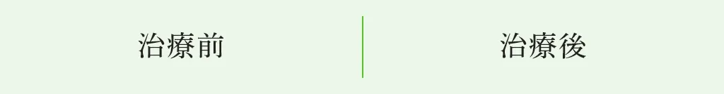 治療前